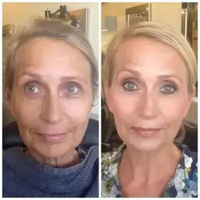 Ageless Skin Kit (+2 Free Gifts)